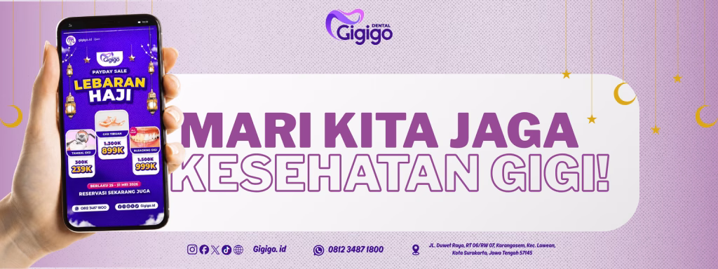 IKLAN GIGIGO (1)